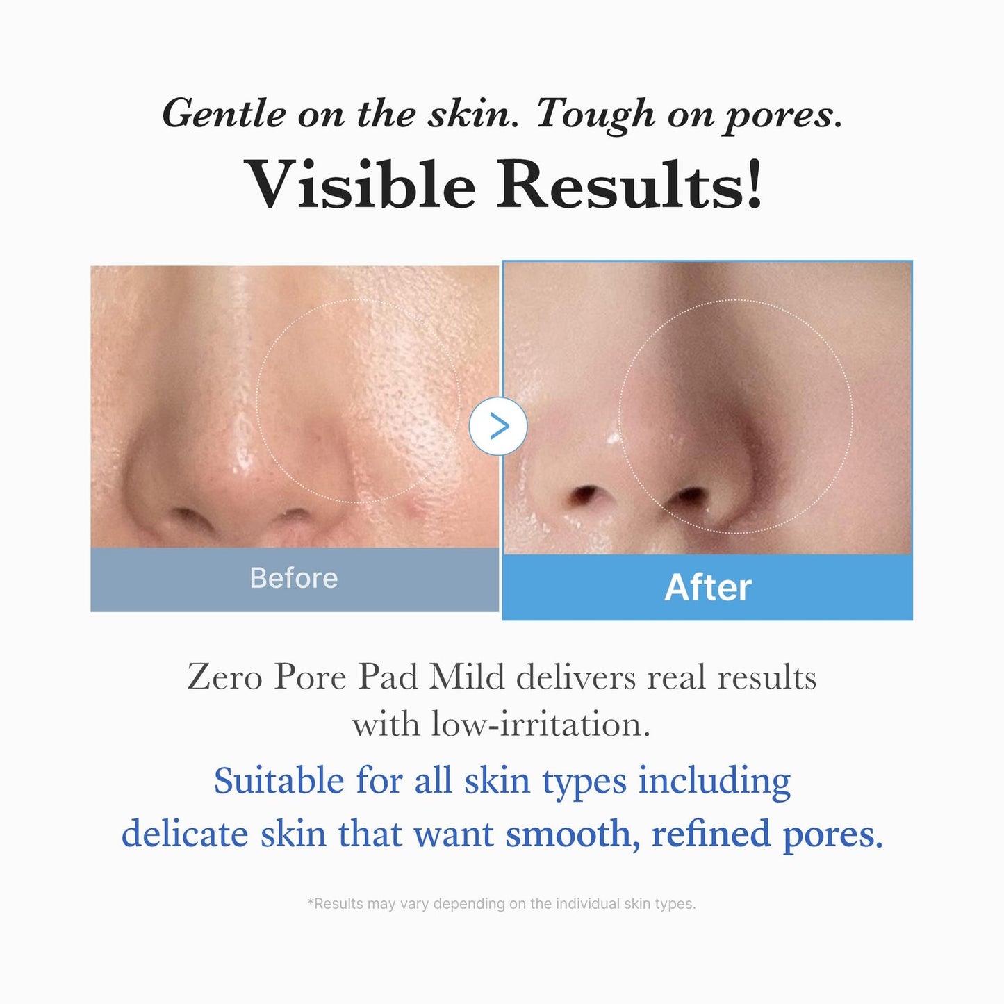 Medicube Zero Pore Pad Mild – Disques Exfoliants Doux pour Pores & Texture de Peau