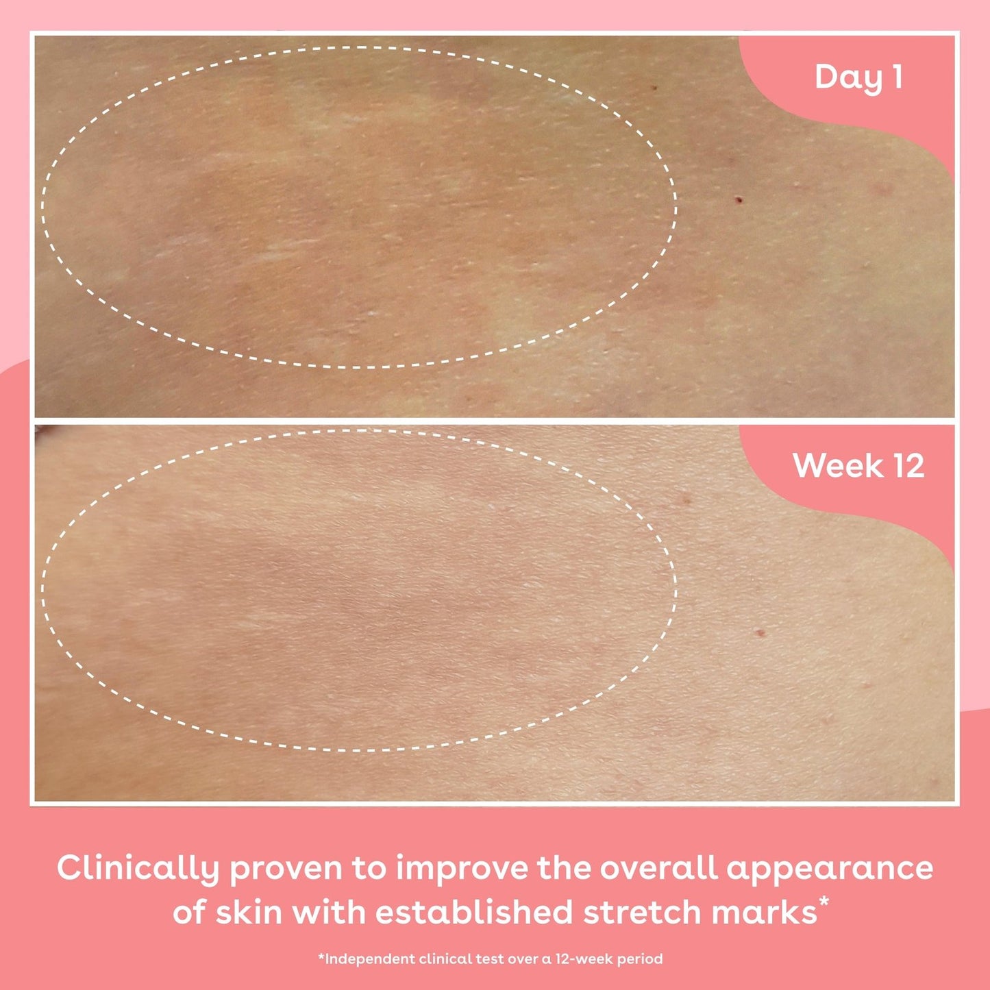 Q+A Collagen Firming Body Oil 150ml