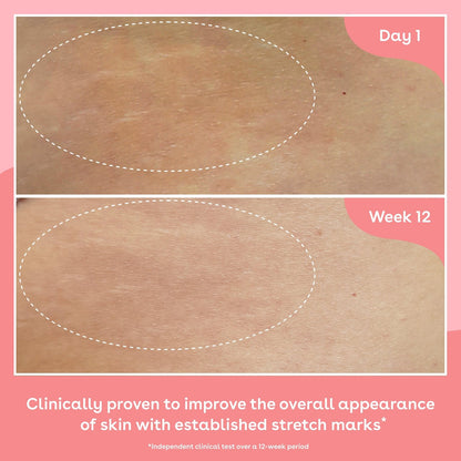 Q+A Collagen Firming Body Oil 150ml