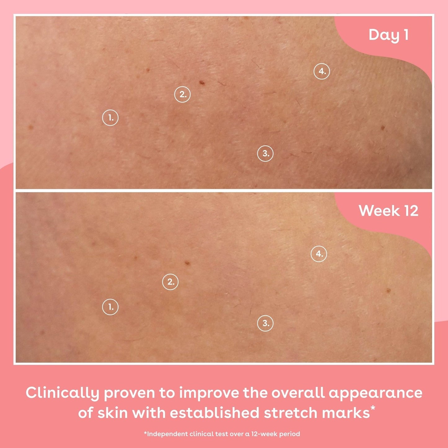 Q+A Collagen Firming Body Oil 150ml